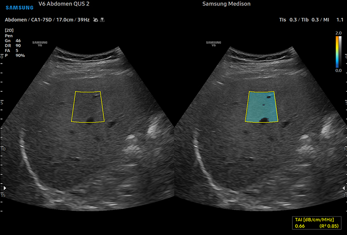 조직 자기영상(TAI)