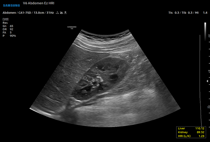해상도 향상 영상