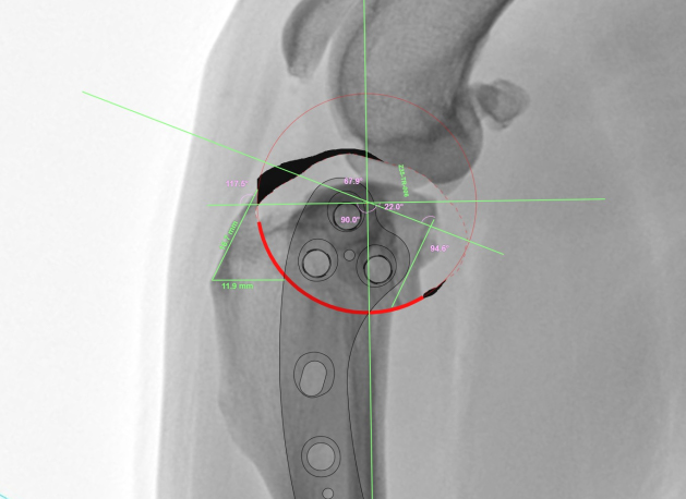 수술 전 각도 조정 이미지