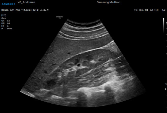 심장 초음파 예시 이미지 01