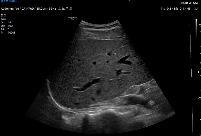 심장 초음파 예시 이미지 03