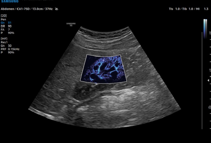심장 초음파 예시 이미지 05