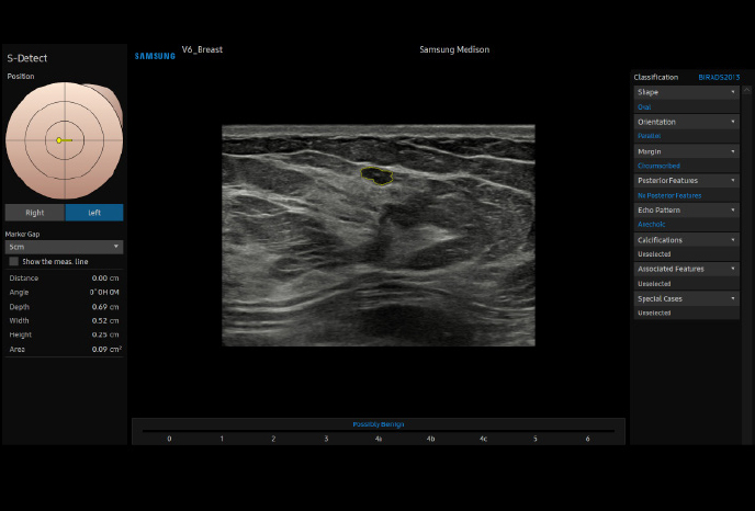 심장 초음파 예시 이미지 10