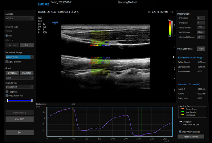 심장 초음파 예시 이미지 16