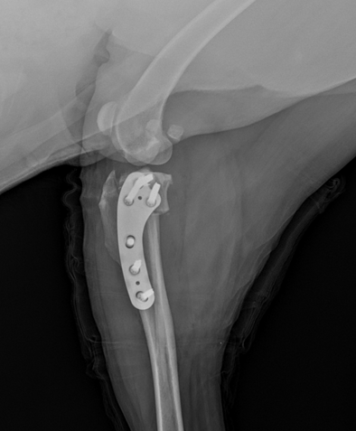십자인대 수술 이미지