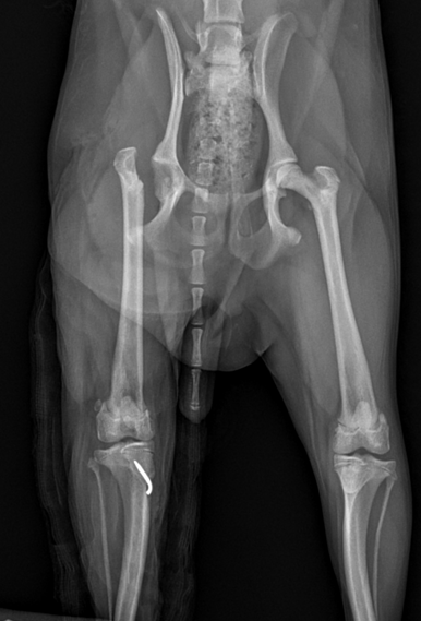허혈성 괴사증 이미지
